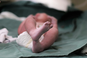 Birth Injury Lawyer in Suisun City, CA