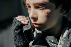 Injured boy