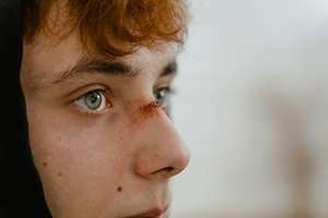Personal Injury Lawyer in Santa Ana, CA