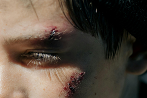 Personal Injury Lawyer in Visalia, CA