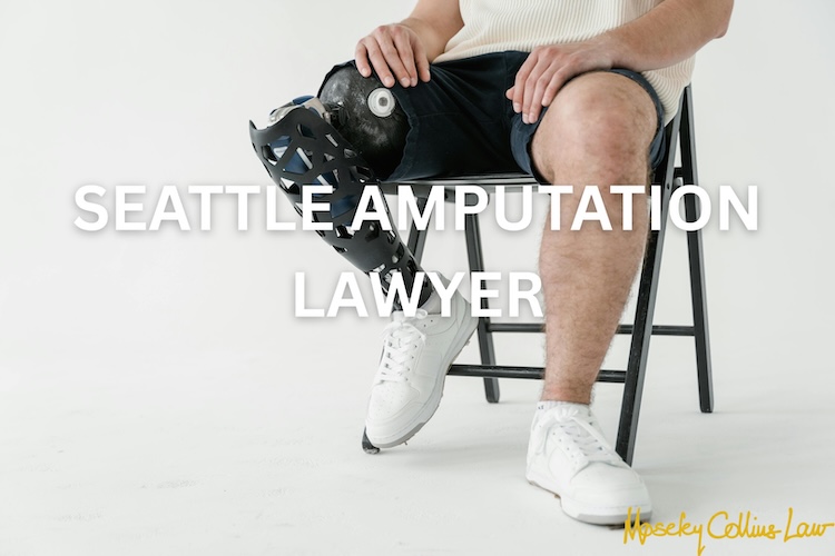 Seattle Amputation Lawyer